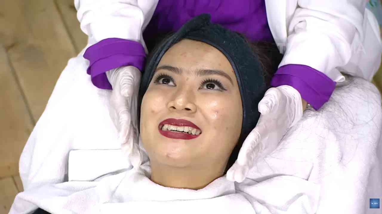 BASA-BASI: Cara Mengatasi Jerawat, Kapan Waktunya Periksa ke Dokter?